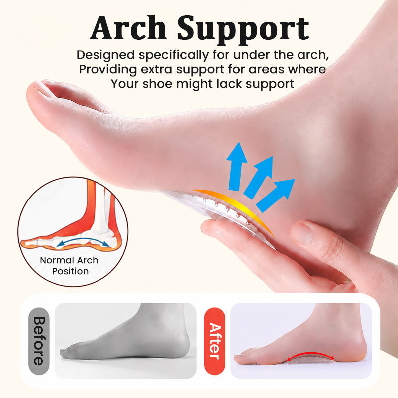 🦶☁️ Coussins de soutien de la voûte plantaire transparents — un soutien discret pour vos pieds au quotidien