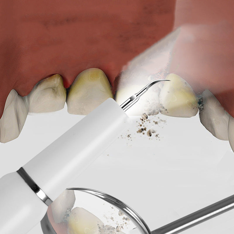🦷 Nettoyeur dentaire à ultrasons rechargeable--Éliminateur électrique de plaque et de tartre avec lumière LED
